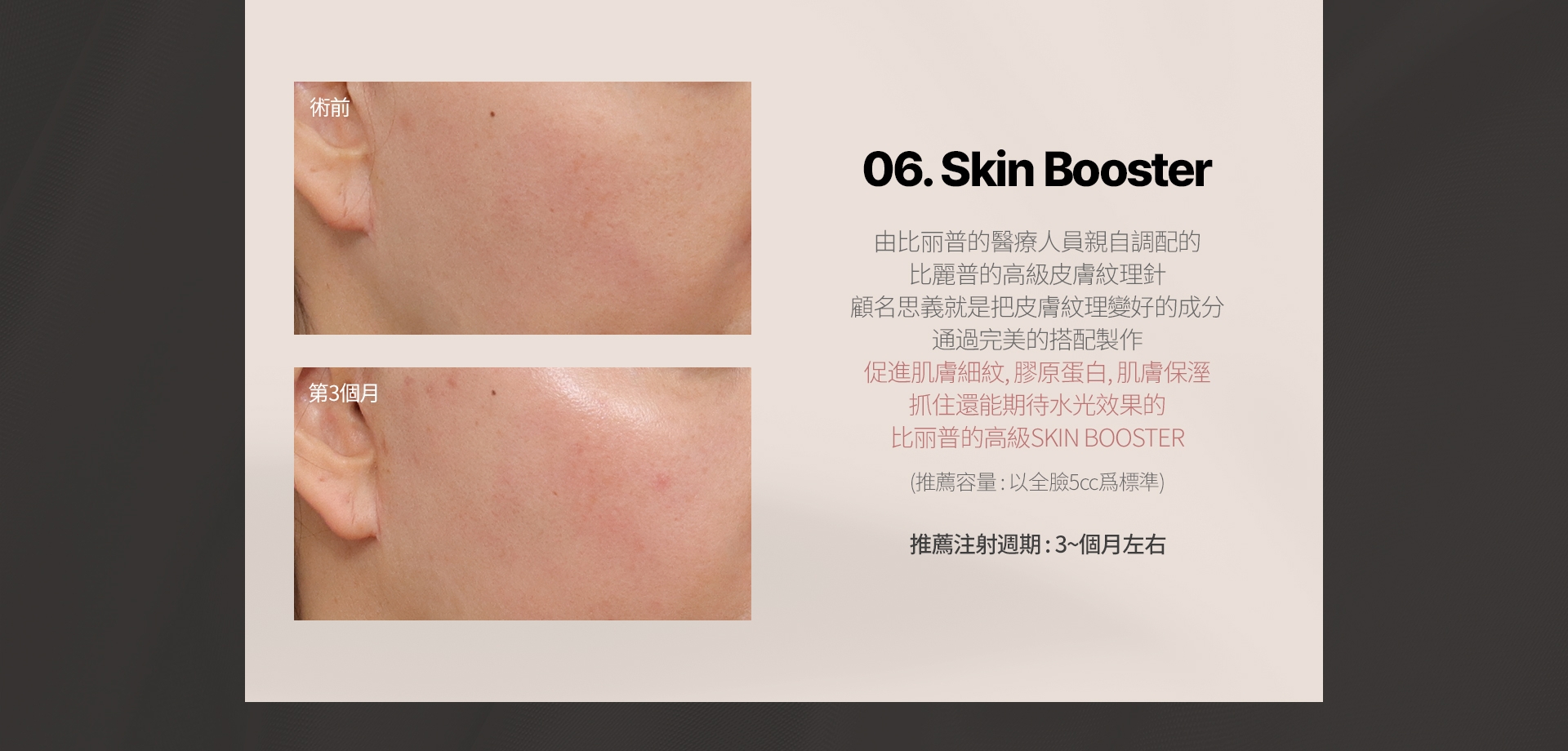 06. Skin Booster 由比丽普的醫療人員親自調配的 比麗普的高級皮膚紋理針 顧名思義就是把皮膚紋理變好的成分 通過完美的搭配製作 促進肌膚細紋、膠原蛋白、肌膚保溼 抓住還能期待水光效果的 比丽普的高級SKIN BOOSTER 推薦容量:以全臉5cc爲標準 推薦注射週期: 3~個月左右