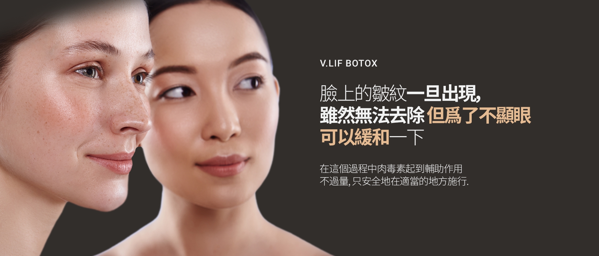 V.LIF BOTOX 臉上的皺紋一旦出現， 雖然無法去除，但爲了不顯眼 可以緩和一下 在這個過程中肉毒素起到輔助作用 不過量，只安全地在適當的地方施行。