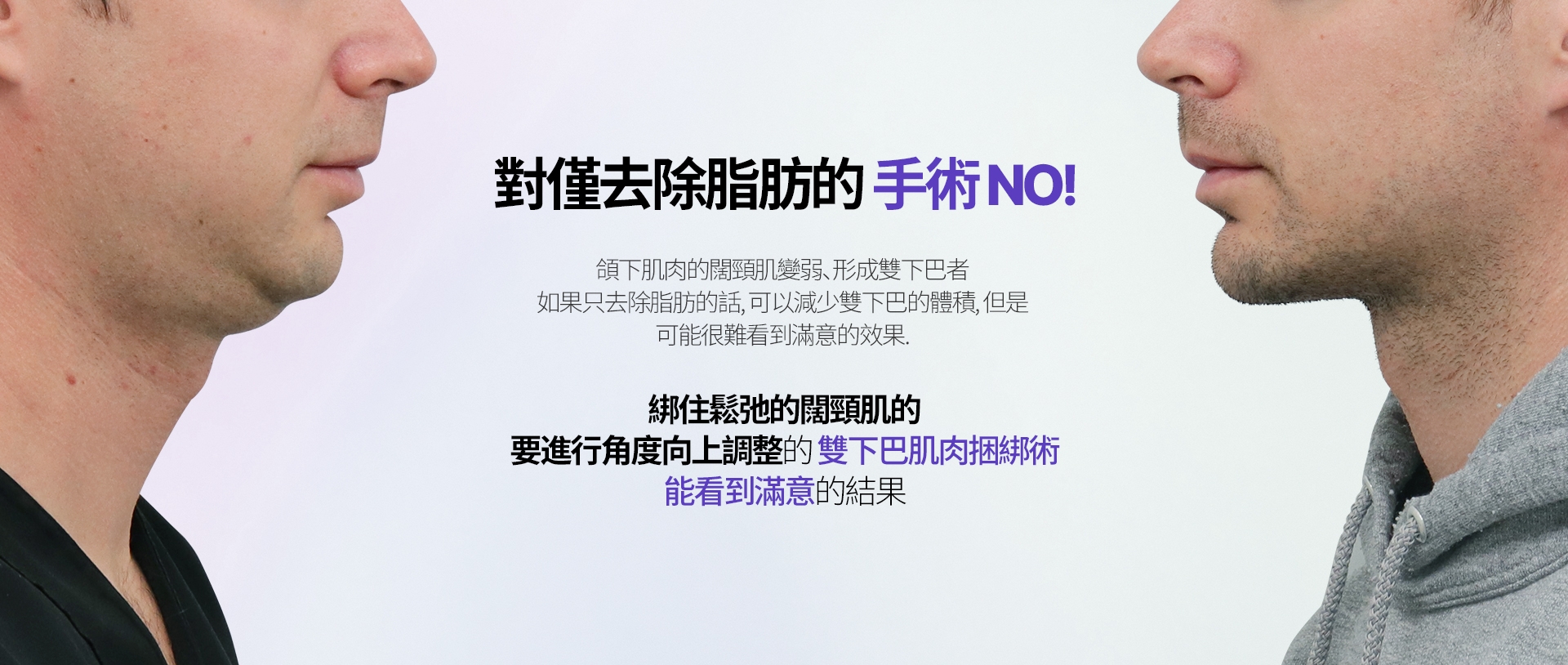 對僅去除脂肪的手術NO！ 頜下肌肉的闊頸肌變弱、形成雙下巴者 如果只去除脂肪的話，可以減少雙下巴的體積，但是 可能很難看到滿意的效果。 綁住鬆弛的闊頸肌的 要進行角度向上調整的雙下巴肌肉捆綁術 能看到滿意的結果