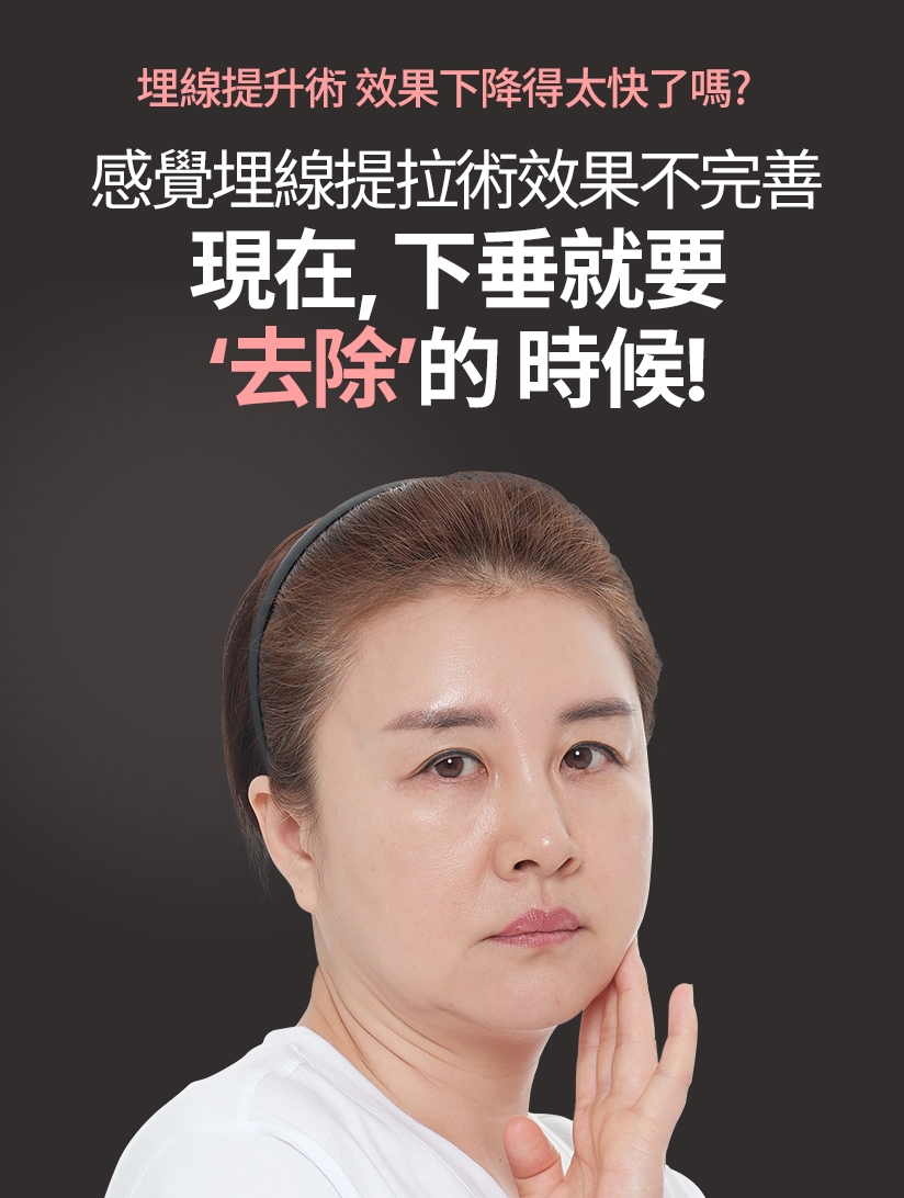 埋線提升術 效果下降得太快了嗎？感覺埋線提拉術效果不完善 現在，下垂就要 “ 去除 ”的 時候 