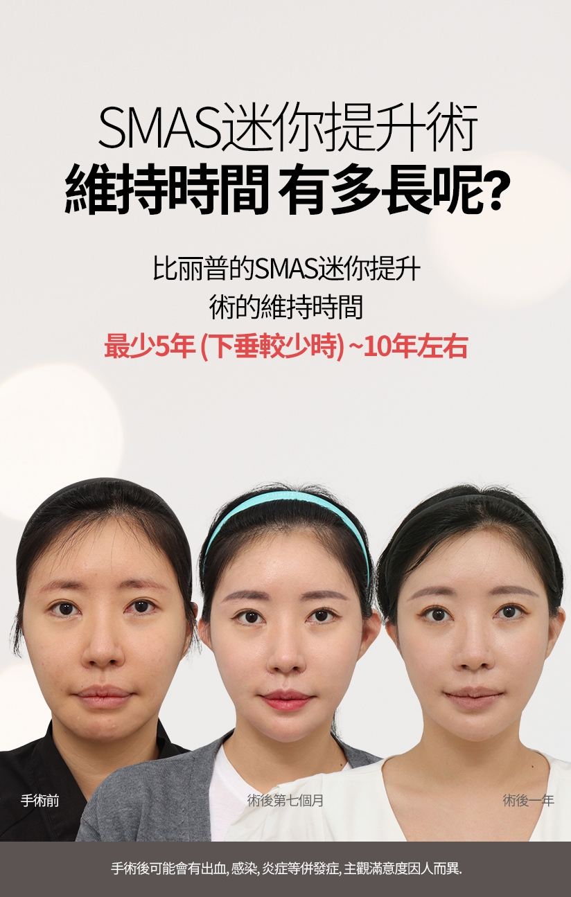 SMAS迷你提升術 維持時間 有多長呢? 比麗普的SMAS迷你提升術的維持時間 最少5年（下垂較少時）~ 10年左右 手術前 術後第七個月 術後一年