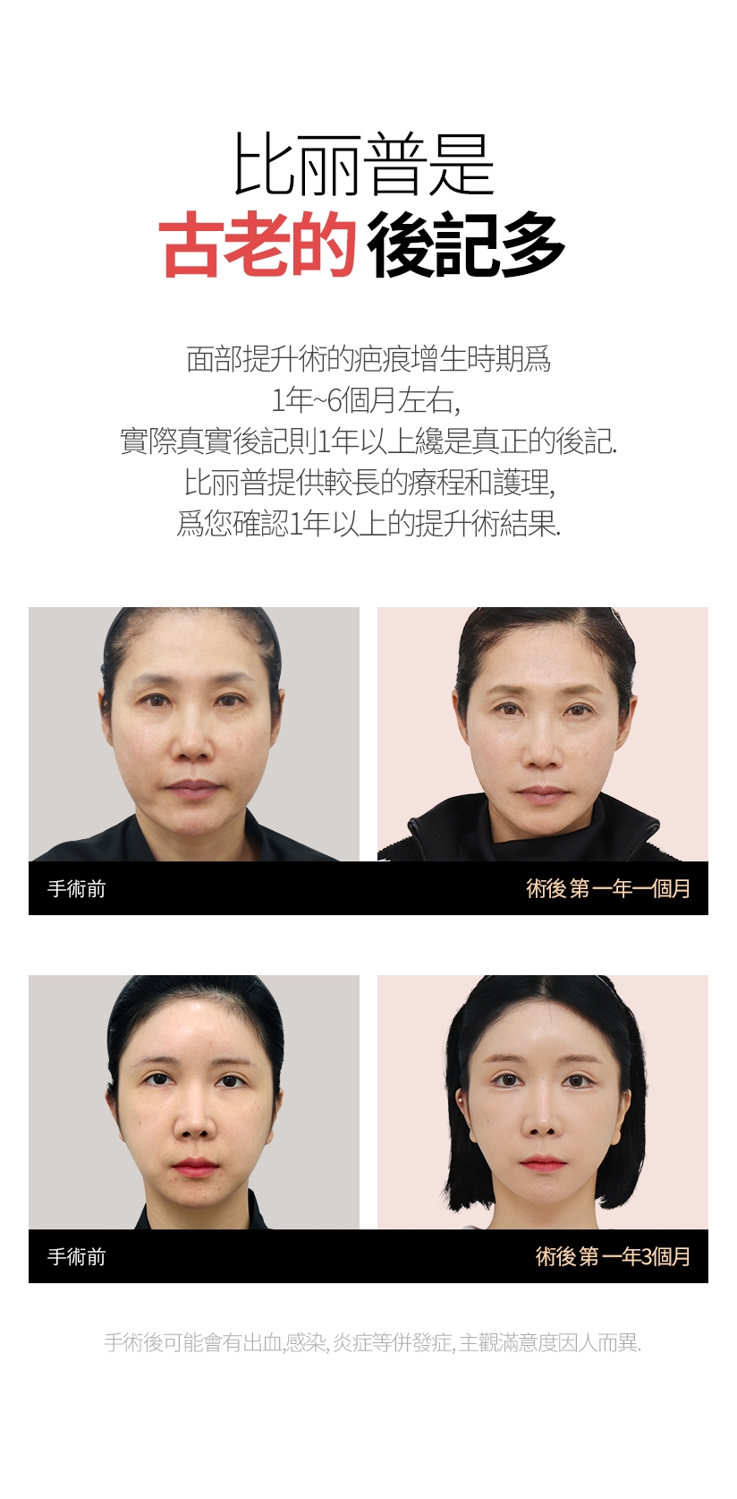 比丽普是  古老的  後記多 面部提升術的疤痕增生時期爲1年~6個月左右，實際真實後記則1年以上纔是真正的後記。 比麗普提供較長的療程和護理，爲您確認1年以上的提升術結果。手术后可能会有出血, 感染, 炎症等并发症, 主观满意度因人而异.