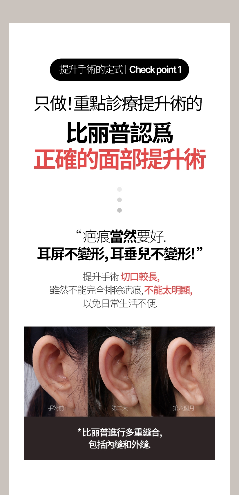 提升手術的定式/ Check point 1 只做！重點診療提升術的 比丽普認爲正確的面部提升術 “疤痕當然要好。 耳屏不變形，耳垂兒不變形！” 提升手術切口較長，雖然不能完全排除疤痕， 不能太明顯，以免日常生活不便。 比丽普進行多重縫合，包括內縫和外縫。/ 提升手術的定式