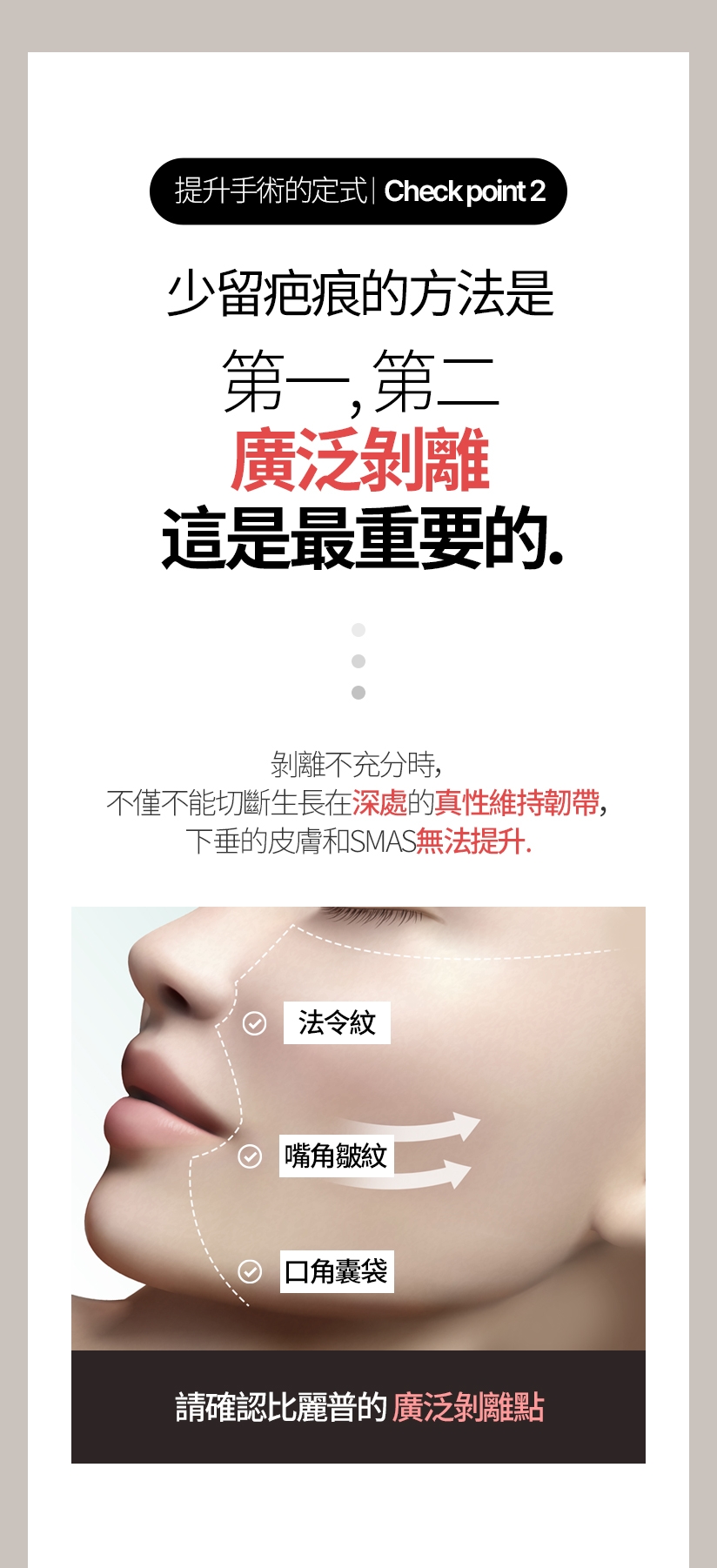 提升手術的定式/ Check point  2 少留疤痕的方法是 第一，第二，廣泛剝離，這是最重要的 剝離不充分時，不僅不能切斷生長在深處的真性維持韌帶,下垂的皮膚和SMAS無法提升。請確認比麗普的廣泛剝離點。