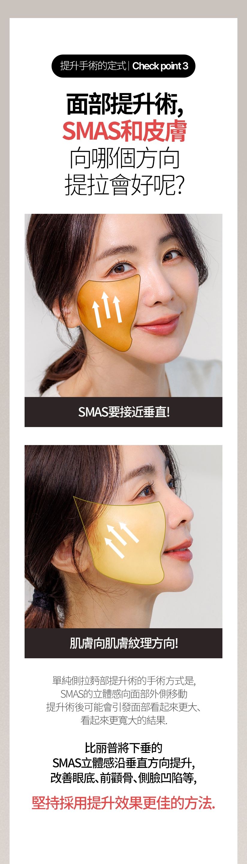 提升手術的定式/ Check point  3 面部提升術,SMAS和皮膚 向哪個方向 提拉會好呢？ SMAS要接近垂直! 肌膚向肌膚紋理方向！ 單純側拉麪部提升術的手術方式是,SMAS的立體感向面部外側移動 提升術後可能會引發面部看起來更大、看起來更寬大的結果。比麗普將下垂的SMAS立體感沿垂直方向提升,改善眼底、前顴骨、側臉凹陷等, 堅持採用提升效果更佳的方法。