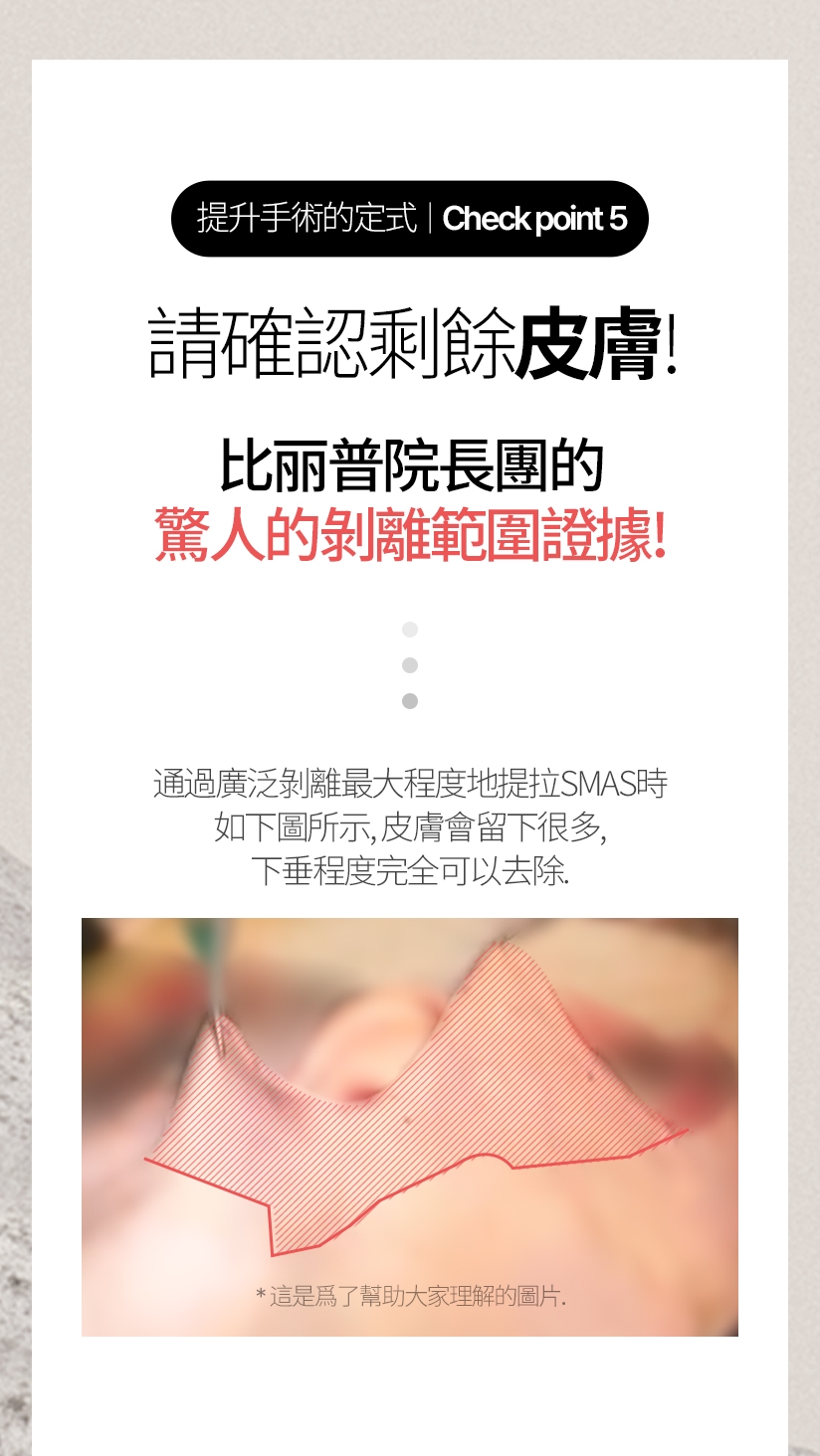 提升手術的定式/ Check point  5 請確認剩餘皮膚。比丽普院長團的 驚人的剝離範圍證據！ 通過廣泛剝離最大程度地提拉SMAS時 如下圖所示，皮膚會留下很多，下垂程度完全可以去除。這是爲了幫助大家理解的圖片