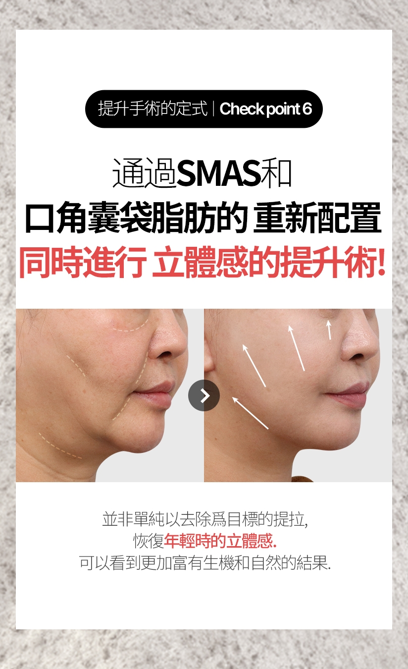 提升手術的定式/ Check point  6 通過SMAS和口角囊袋脂肪的重新配置 同時進行 立體感的提升術! 並非單純以去除爲目標的提拉，恢復年輕時的立體感。 可以看到更加富有生機和自然的結果。