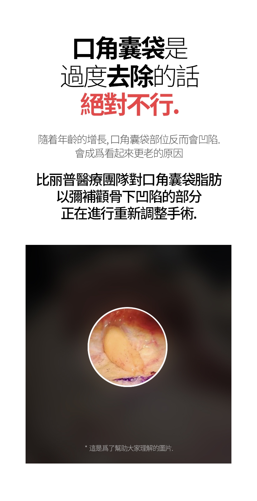 口角囊袋是 過度去除的話 絕對不行。 隨着年齡的增長，口角囊袋部位反而會凹陷。 會成爲看起來更老的原因。 比丽普醫療團隊對口角囊袋脂肪 以彌補顴骨下凹陷的部分 正在進行重新調整手術。