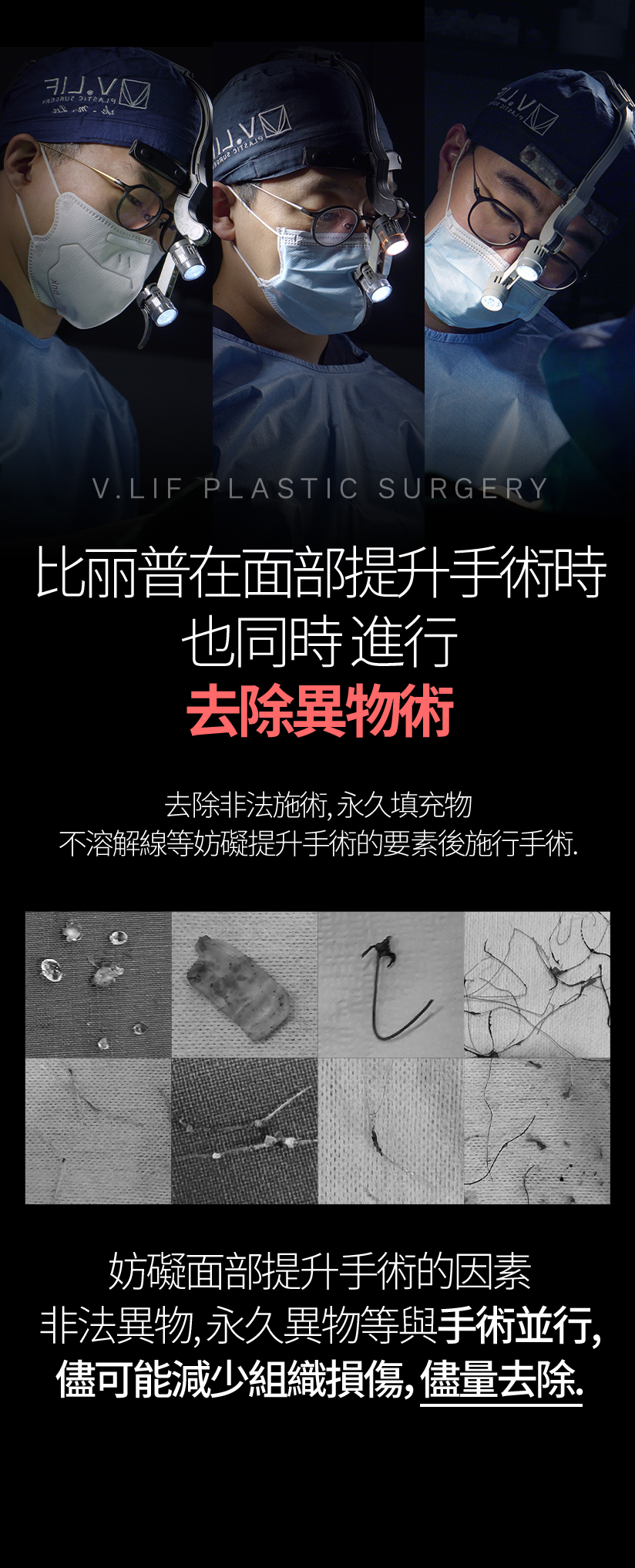 比丽普在面部提升手術時 也同時 進行 去除異物術 去除非法施術、永久填充物、不溶解線等妨礙提升手術的要素後施行手術。妨礙面部提升手術的因素 非法異物、永久異物等與手術並行，儘可能減少組織損傷，儘量去除。