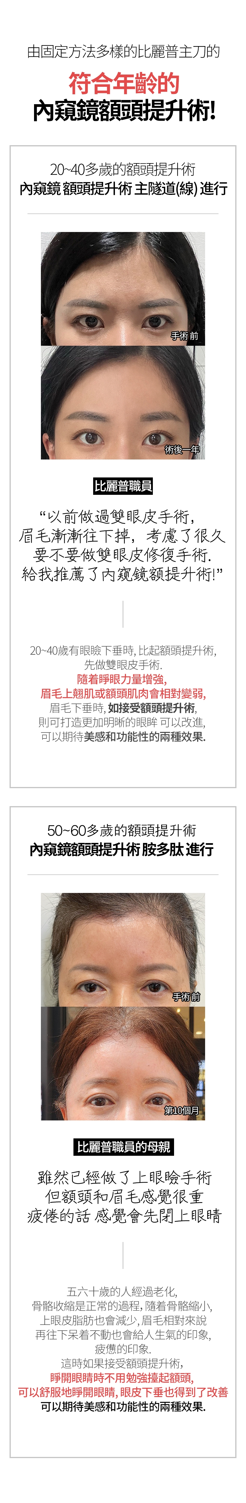 由固定方法多樣的比麗普主刀的 符合年齡的內窺鏡額頭提升術！ 20~40多歲的額頭提升術 內窺鏡 額頭提升術 主隧道(線） 進行  手術 前 術後一年 比麗普職員 以前做過雙眼皮手術，眉毛漸漸往下掉，考慮了很久 要不要做雙眼皮修復手術。給我推薦了內窺鏡額提升術 20~40歲有眼瞼下垂時，比起額頭提升術，先做雙眼皮手術。隨着睜眼力量增強，眉毛上翹肌或額頭肌肉會相對變弱， 眉毛下垂時，如接受額頭提升術，則可打造更加明晰的眼眸 可以改進，可以期待美感和功能性的兩種效果。50~60多歲的額頭提升術 內窺鏡額頭提升術 胺多肽 進行 手術 前 第10個月 比麗普職員的母親 雖然已經做了上眼瞼手術 但額頭和眉毛感覺很重 疲倦的話 感覺會先閉上眼睛 五六十歲的人經過老化，骨骼收縮是正常的過程，隨着骨骼縮小，上眼皮脂肪也會減少，眉毛相對來說 再往下呆着不動也會給人生氣的印象、疲憊的印象。 這時如果接受額頭提升術，睜開眼睛時不用勉強擡起額頭， 可以舒服地睜開眼睛，眼皮下垂也得到了改善 可以期待美感和功能性的兩種效果。