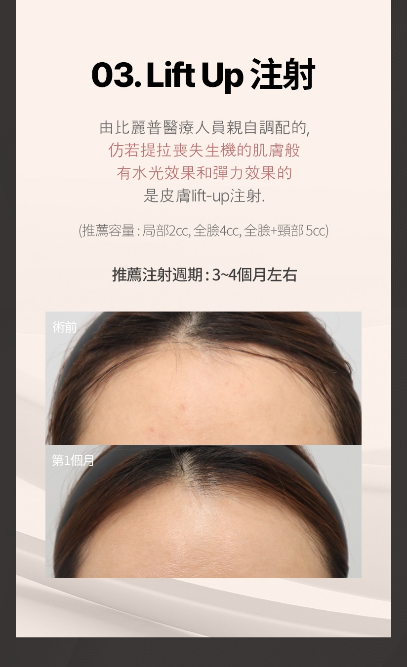 03. Lift Up 注射 由比麗普醫療人員親自調配的、仿若提拉喪失生機的肌膚般 有水光效果和彈力效果的 是皮膚lift-up注射。推薦容量: 局部2cc，全臉4cc，全臉+頸部 5cc 推薦注射週期: 3~4個月左右