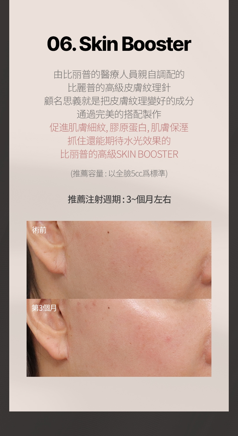 06. Skin Booster 由比丽普的醫療人員親自調配的 比麗普的高級皮膚紋理針 顧名思義就是把皮膚紋理變好的成分 通過完美的搭配製作 促進肌膚細紋、膠原蛋白、肌膚保溼 抓住還能期待水光效果的 比丽普的高級SKIN BOOSTER 推薦容量:以全臉5cc爲標準 推薦注射週期: 3~個月左右