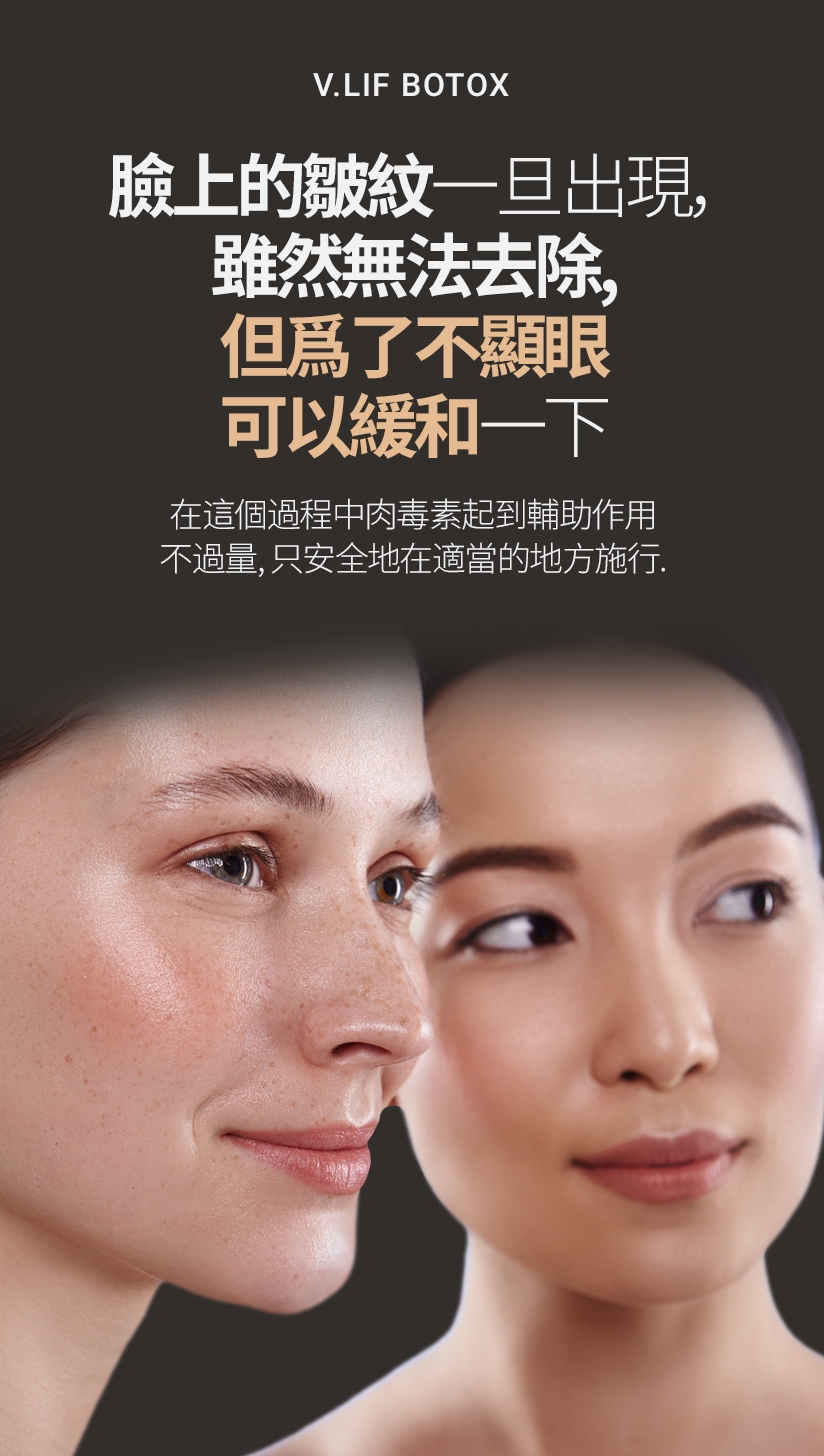 V.LIF BOTOX 臉上的皺紋一旦出現， 雖然無法去除，但爲了不顯眼 可以緩和一下 在這個過程中肉毒素起到輔助作用 不過量，只安全地在適當的地方施行。