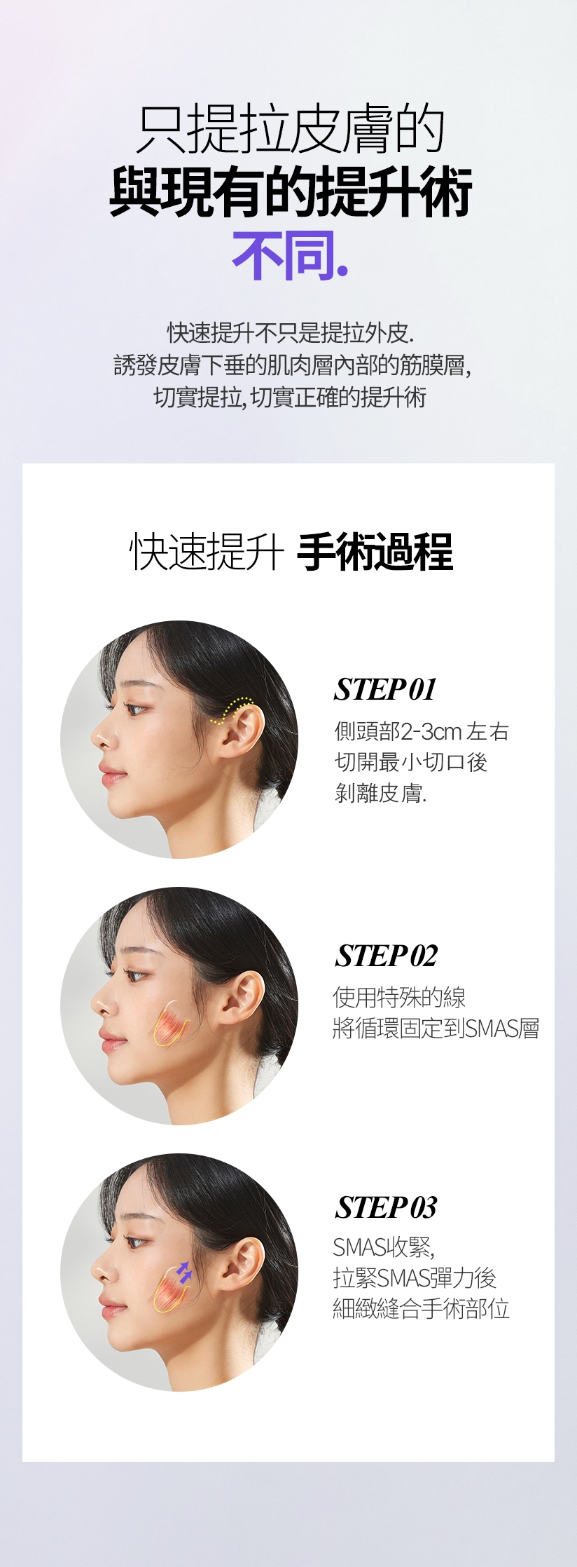 只提拉皮膚的 與現有的提升術不同 快速提升不只是提拉外皮。 誘發皮膚下垂的肌肉層內部的筋膜層，切實提拉、切實正確的提升術 快速提升 手術過程 STEP 01 側頭部2-3cm左右 切開最小切口後剝離皮膚, STEP 02 使用特殊的線 將循環固定到SMAS層, STEP 03 SMAS收緊，拉緊SMAS彈力後 細緻縫合手術部位