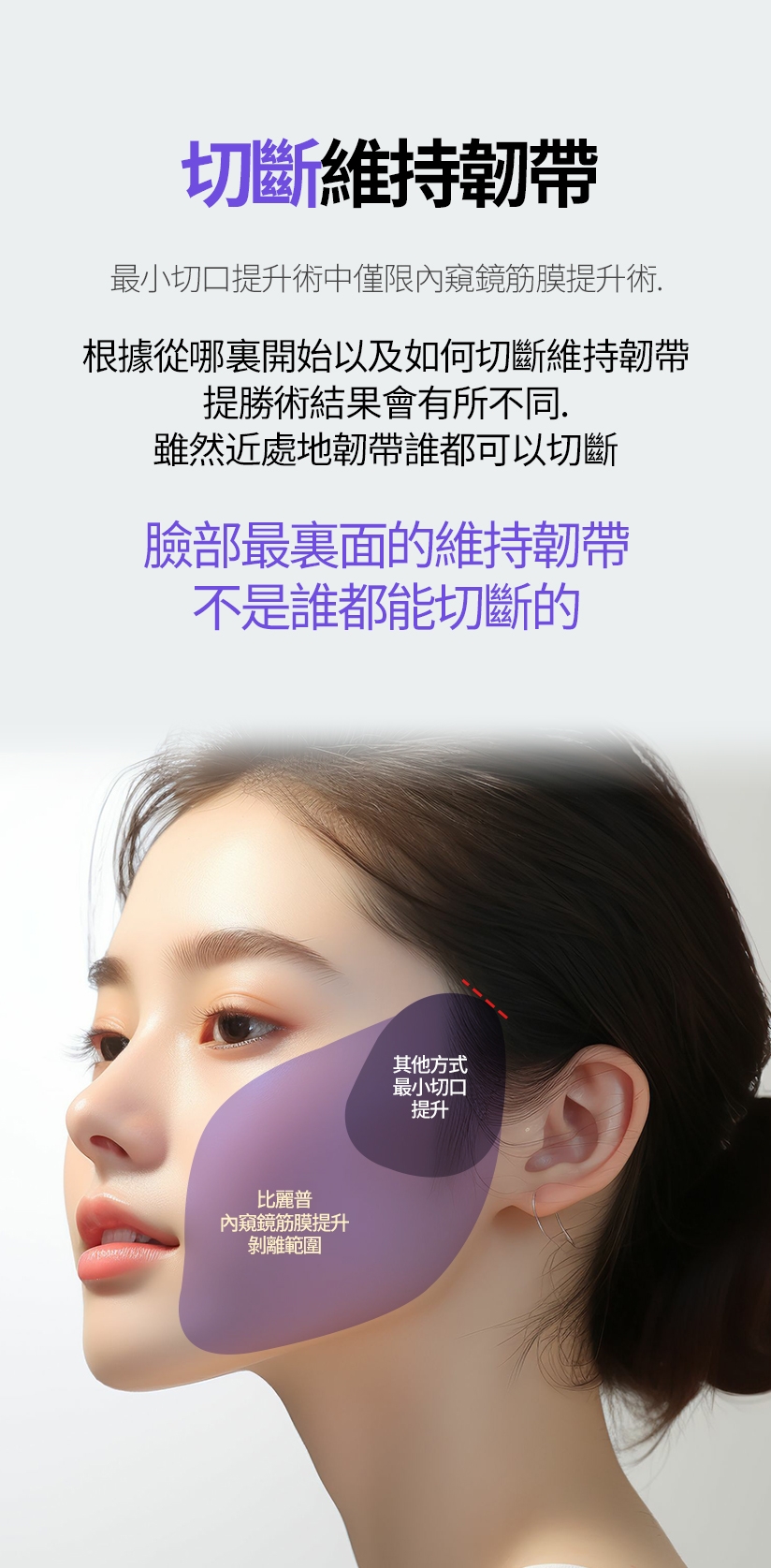 切斷維持韌帶 最小切口提升術中僅限內窺鏡筋膜提升術。根據從哪裏開始以及如何切斷維持韌帶 提勝術結果會有所不同。雖然近處地韌帶誰都可以切斷 臉部最裏面的維持韌帶 不是誰都能切斷的 其他方式 最小切口 提升 比麗普 內窺鏡筋膜提升 剝離範圍