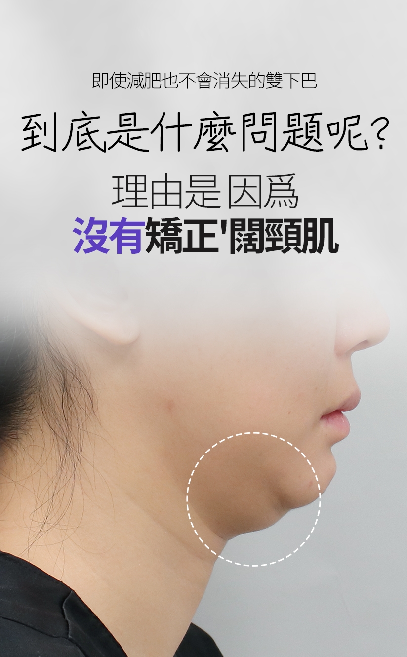 即使減肥也不會消失的雙下巴 到底是什麼問題呢？ 理由是 因爲 沒有矯正'闊頸肌'