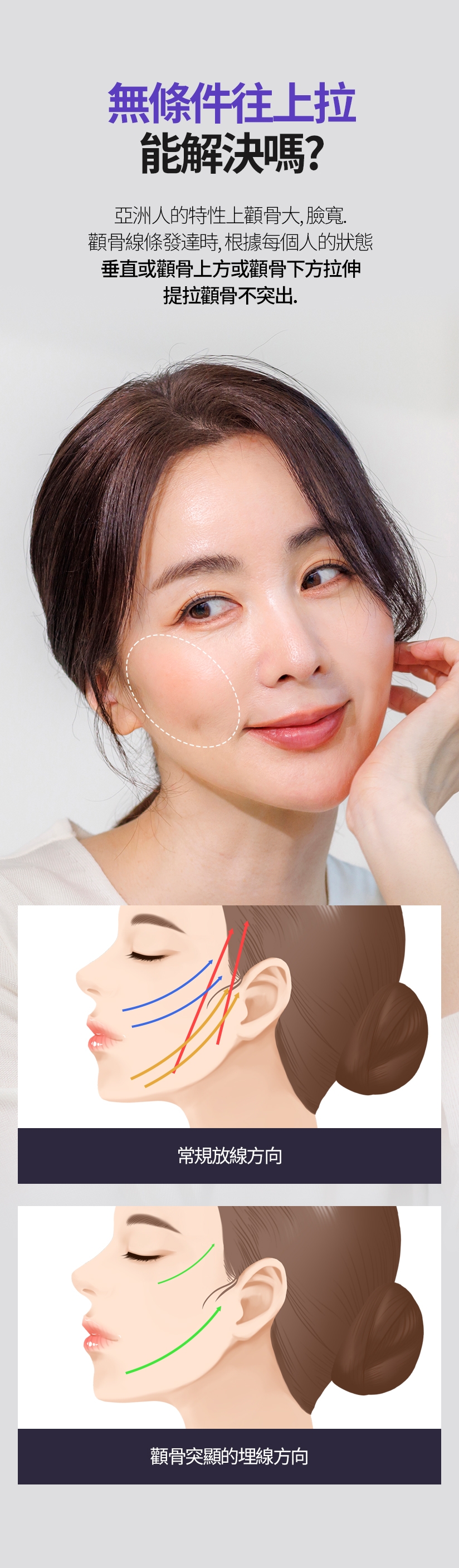 無條件往上拉 能解決嗎？ 亞洲人的特性上顴骨大，臉寬。顴骨線條發達時，根據每個人的狀態 垂直或顴骨上方或顴骨下方拉伸 提拉顴骨不突出 常規放線方向 / 顴骨突顯的埋線方向